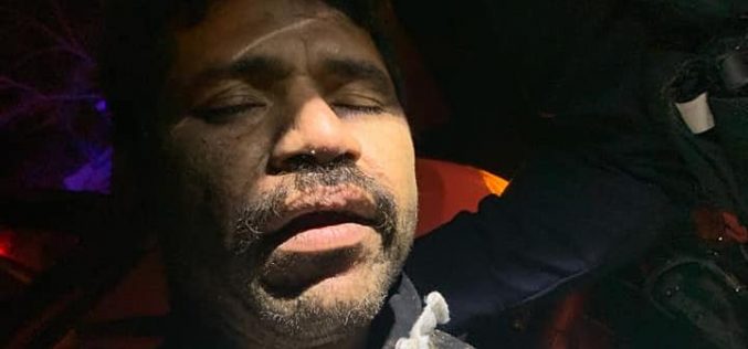 Corning Police: Man barks, tries to bite officers during arrest